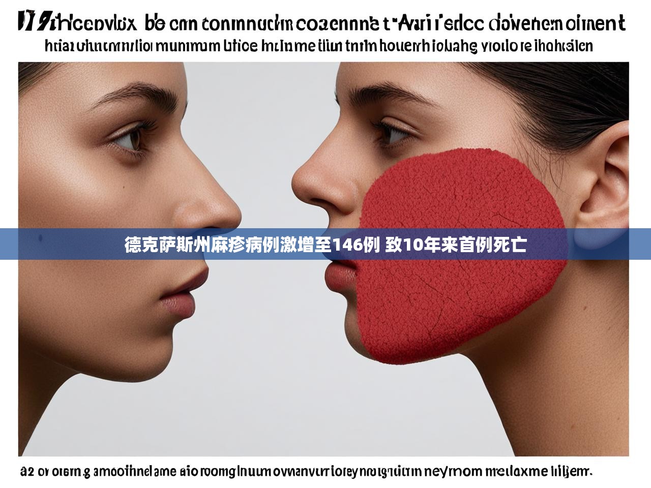 德克萨斯州麻疹病例激增至146例 致10年来首例死亡